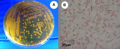 Hưng Long -Khuẩn lạc Vibrio alginolyticus trên môi trường TCBS (A) và hình dạng vi khuẩn ở độ phóng đại 1000 lần (B)