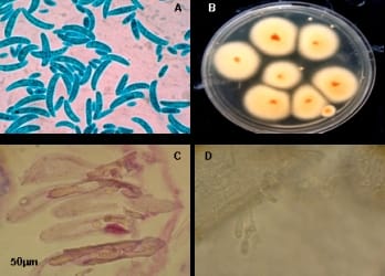 Hưng Long - Bào tử đính nấm Fusarium sp.(A); Khuẩn lạc nấm Fusarium sp. trên môi trường PDA (B); tơ mang tôm hùm bệnh đen mang, lát cắt dọc sợi nấm nằm bên trong tơ mang (đầu mũi tên đen) nhuộm H&E (C); nấm Fusarium sp. ký sinh trên mang tôm hùm ở độ phóng đại 400 lần (D)